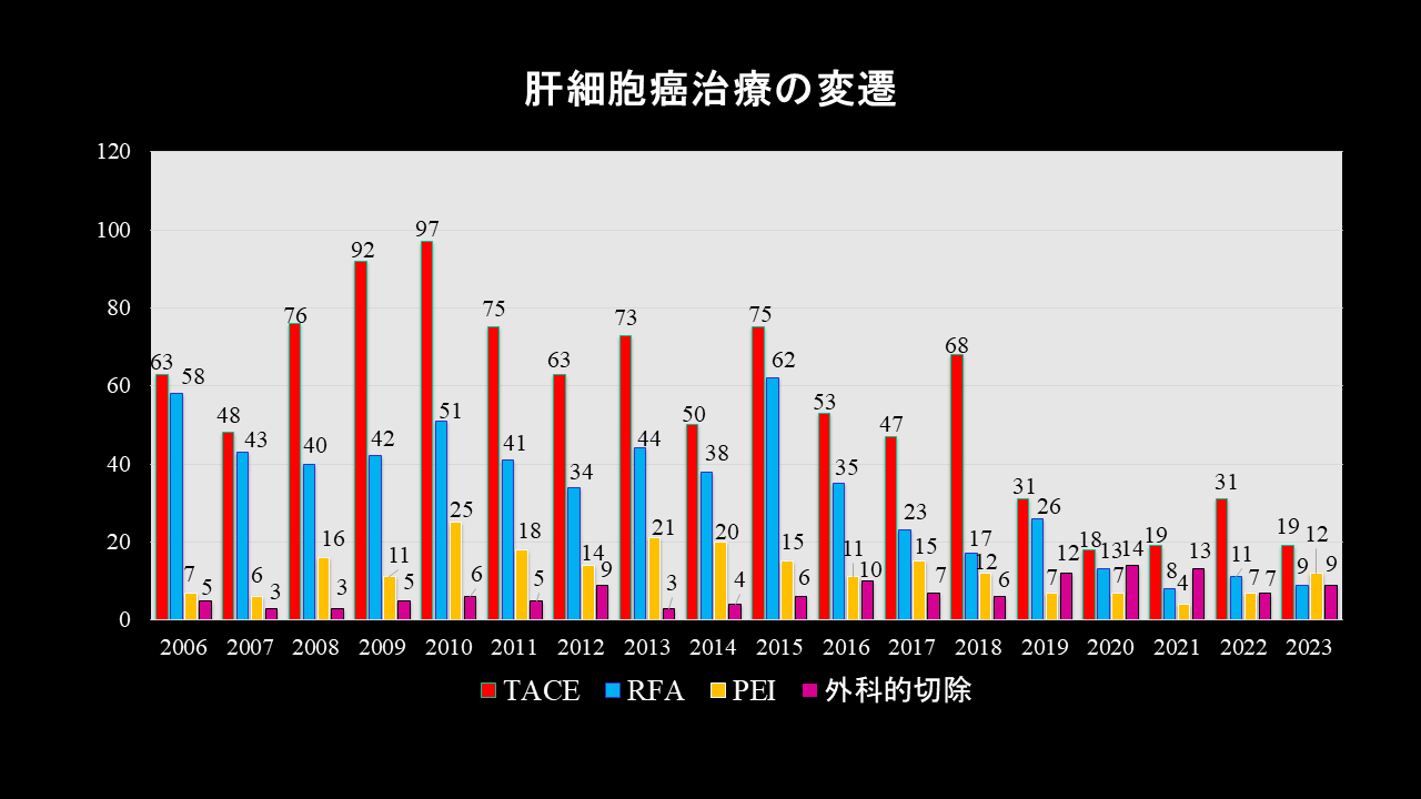 肝細胞癌治療の変遷